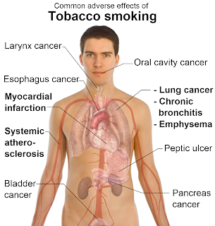 how to reduce the side effect of smoking how to reduce the side effect of smoking