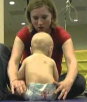 Physical Therapy for Torticollis in Babies PT intervention for Torticollis