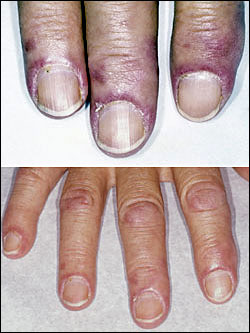 7 early signs of Cancer that you shouldn't ignore! 7 early signs of Cancer that you shouldn't ignore!