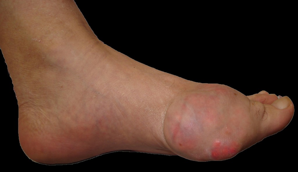 Easy Touch - Test per misurare glucosio e acido urico nel ...