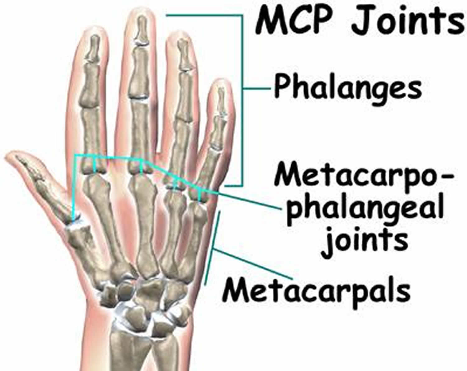 Metacarpophalangeal joint - Medically