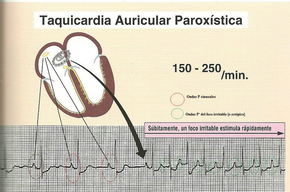 Dr. Rafael Soto Electrocardiografía Cardiología clínica