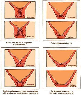 Peaceful Parenting The Myth Of The Vaginal Exam In Pregnancy