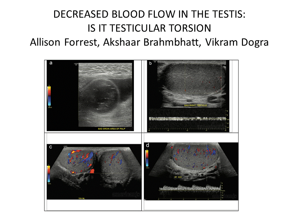 BÀI SOẠN VỀ SIÊU ÂM CHẨN ĐOÁN DECREASED BLOOD FLOW in the TESTIS