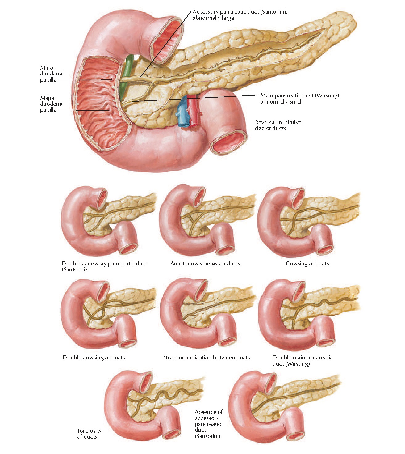 Variations in Pancreatic Duct Anatomy pediagenosis