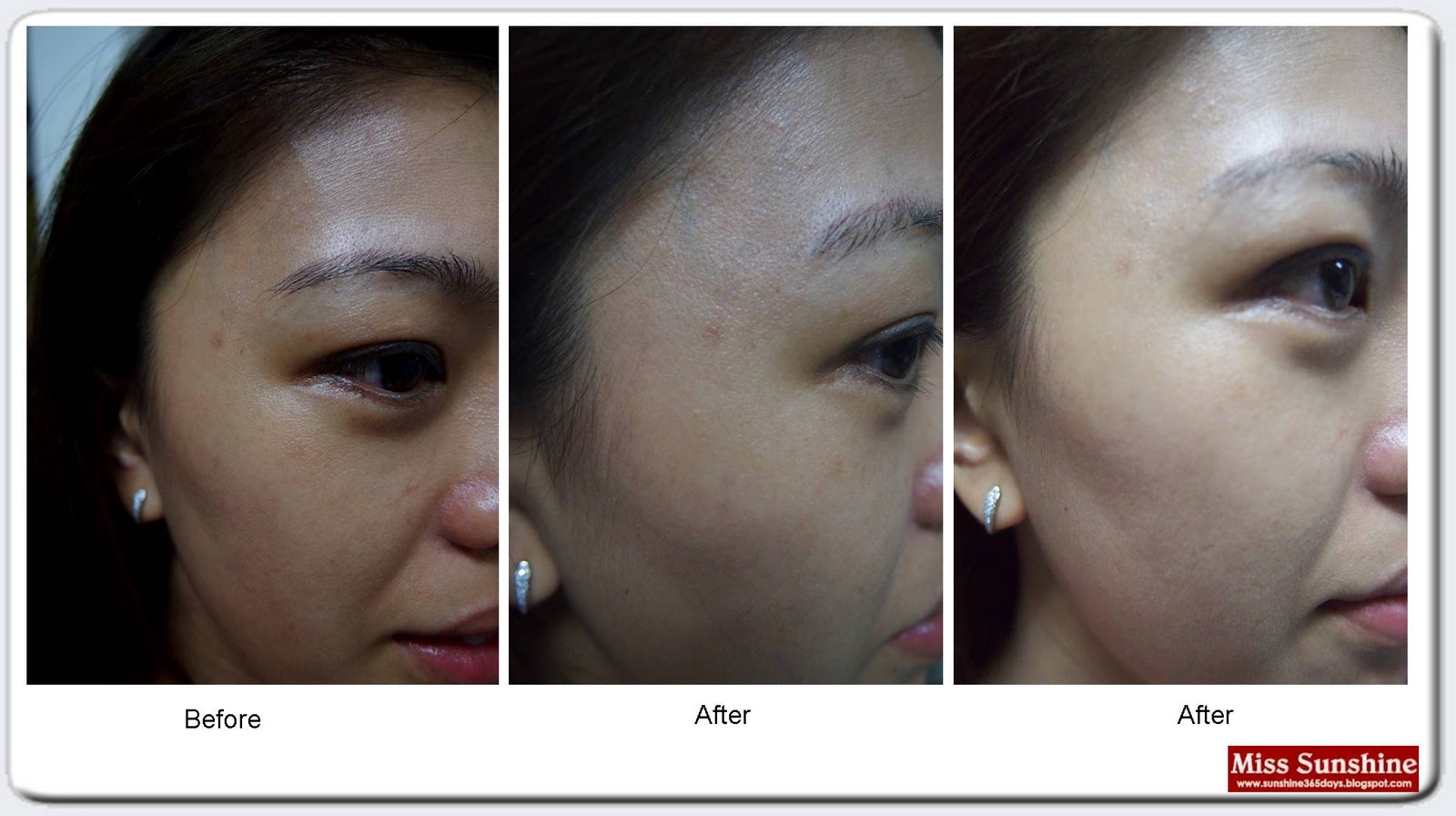 Pure white shiseido before and after Infinings