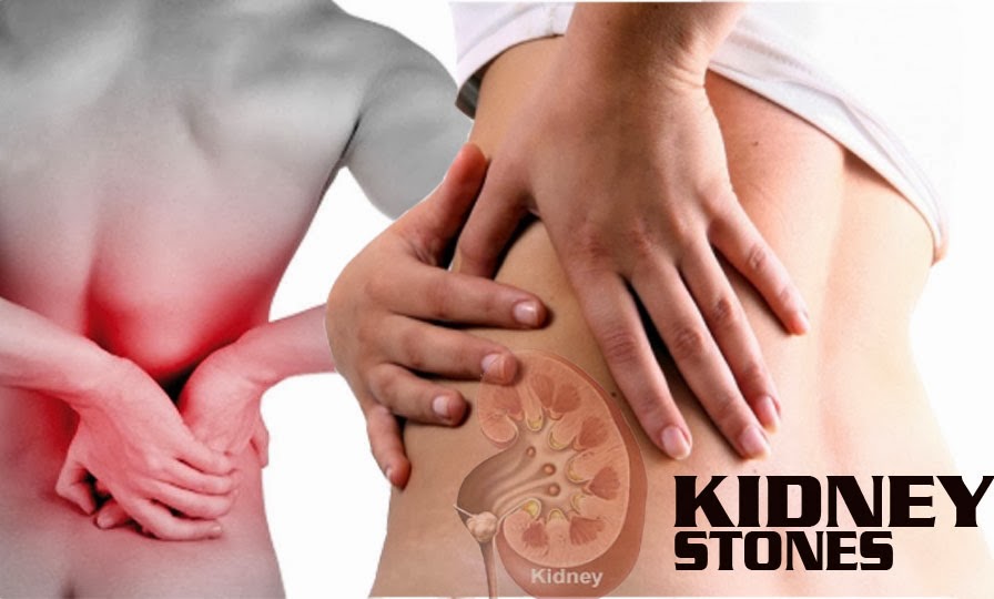 there are several solutions to get rid of kidney stones such as 
