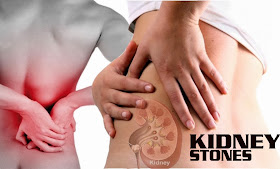 Urinary calculi/ kidney stone and its Ayurveda management