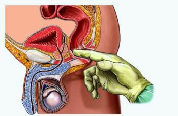 Image Obat ambeien atau hemorrhoid yang manjur