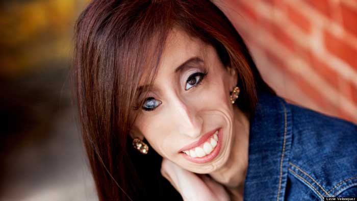 Lizzie Velasquez Lizzie Velasquez