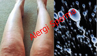 obat herbal untuk menyembuhkan alergi pada sperma obat herbal untuk menyembuhkan alergi pada sperma