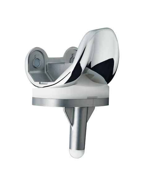 Total knee replacement TYPES OF TOTAL KNEE PROSTHESIS DESIGN