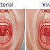 Health Tips - The 5 signs your sore throat could be serious
