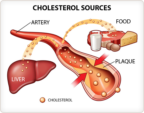 Good Food With No Cholesterol Good Food With No Cholesterol