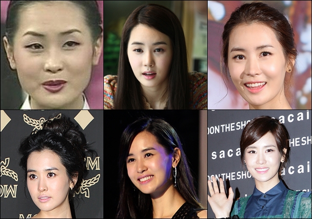 Korea Observer: Lee Da Hae admits getting plastic surgery