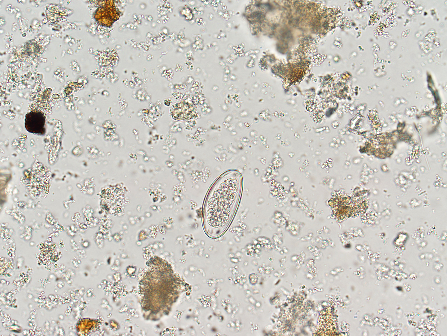 Creepy Dreadful Wonderful Parasites: Case of the Week 434
 Pinworm Eggs In Poop