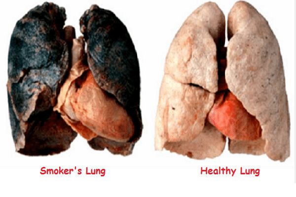 Organ rosak kesan merokok Organ cepat tua dan rosak akibat meroko