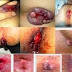 OBAT MUJARAB BAB BERDARAH thumbnail