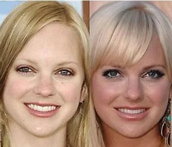 Crisp Jk Rowling Before And After Plastic Surgery Photo Art