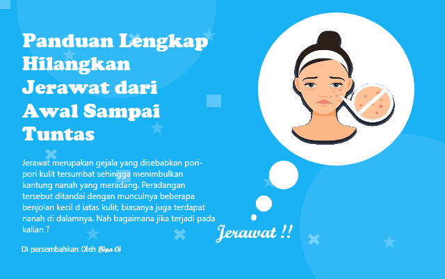 Panduan Lengkap Hilangkan Jerawat dari Awal Sampai Tuntas Panduan Lengkap Hilangkan Jerawat dari Awal Sampai Tuntas