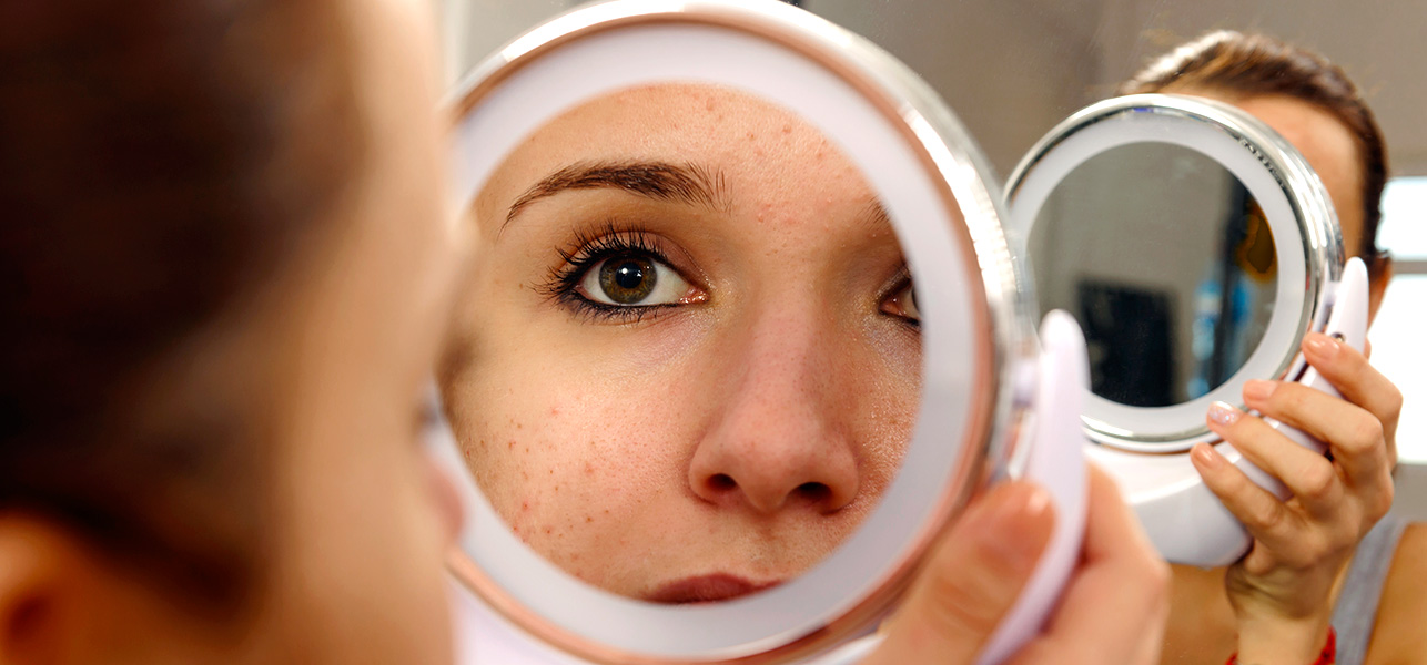 How To Take Care Of Pimples That Are Caused Due To Heat Family Health
