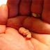 Aborto Retido - Meu relato sobre essa triste experiência