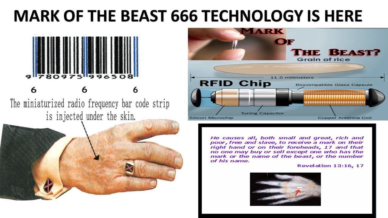 Microchip implant (human)