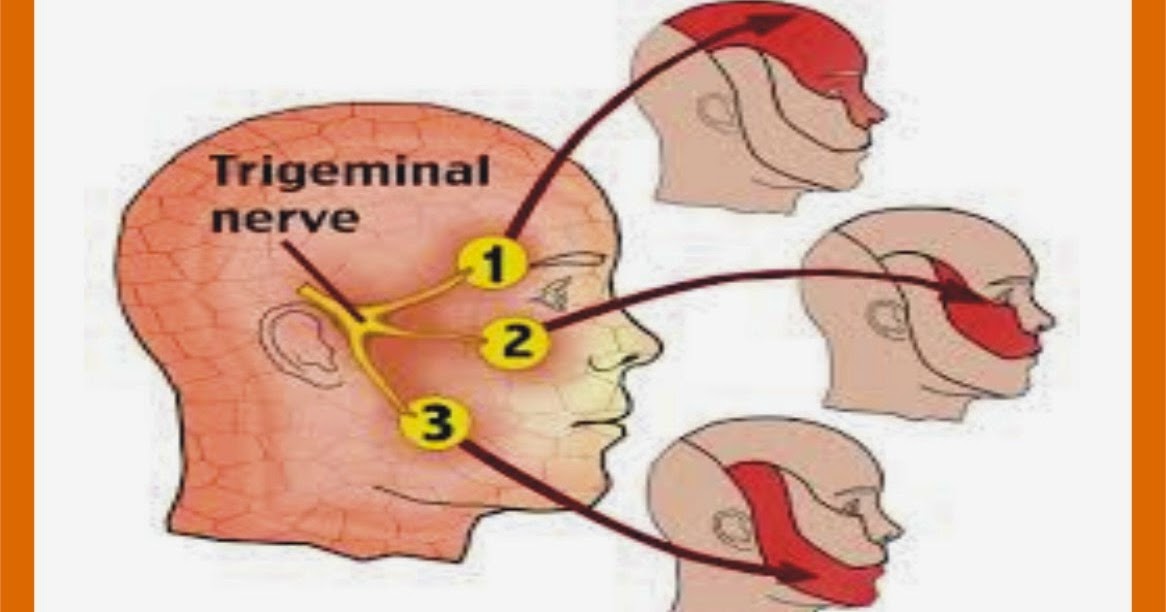 Тройничный нерв. Точки выхода тройничного нерва на лице. Троичный нерв воспален. Ущемление тройничного нерва. Дергается нерв на щеке.