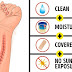 Hacks to Remove All Types of Scars and Help Them Heal