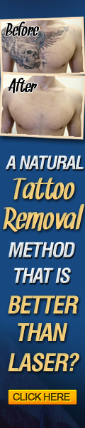 The Laserless Tattoo Removal Guide
