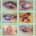 obat ambeien tradisional thumbnail