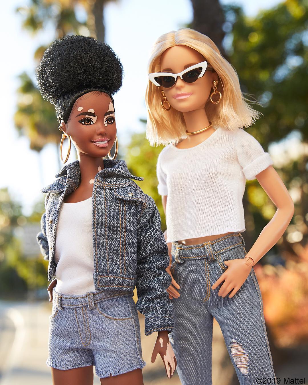 Resultado de imagen para barbie con vitiligo