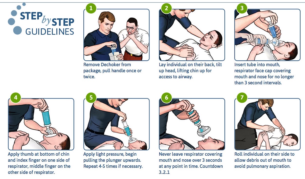 How to Perform the Heimlich Maneuver on a Baby How to Perform the Heimlich Maneuver on a Baby new foto How to Perform the Heimlich Maneuver on a Baby How to Perform the Heimlich Maneuver on a Baby new foto