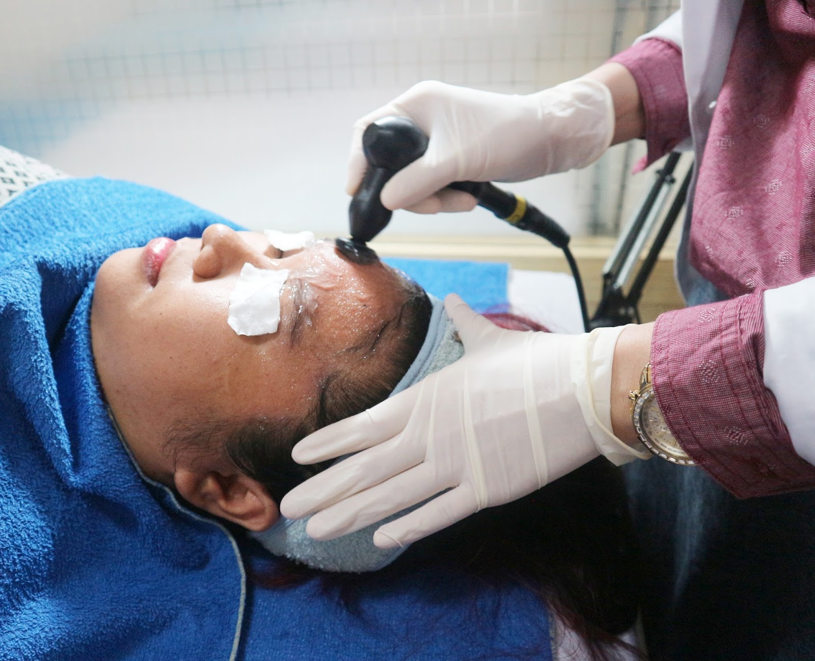 Keliling Klinik Estetika dr. Affandi dan Mencicip Treatment Radio Frequency