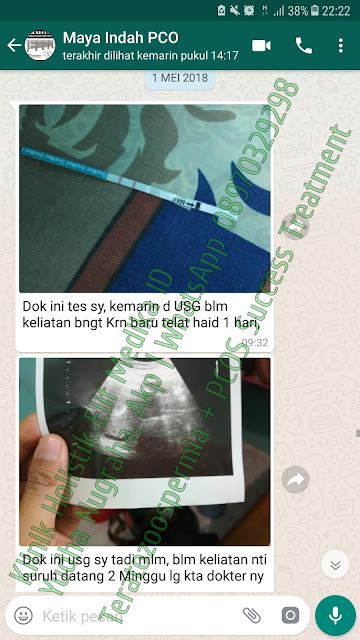 pcos pcos bisa hamil
