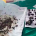 Doctors Removed These From A Woman’s Bladder Because Of Skipping Breakfast Every Morning