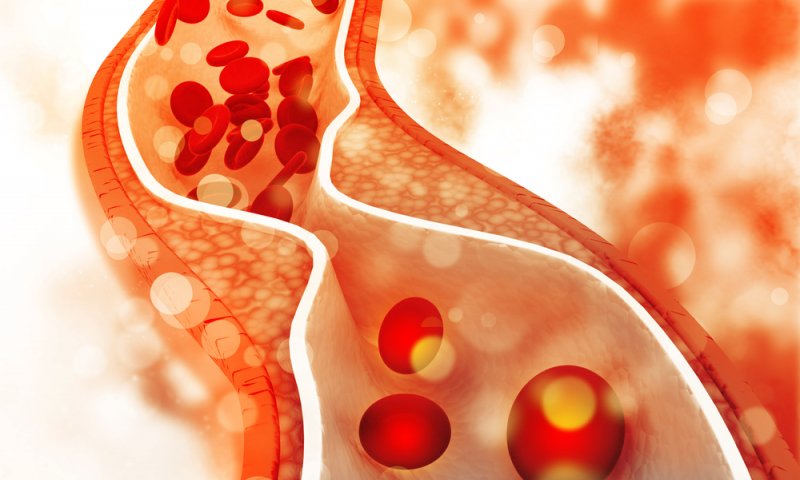 The Hub Scope Top 5 Foods To Lower Bad Cholesterol the-hub-scope-top-5-foods-to-lower-bad-cholesterol