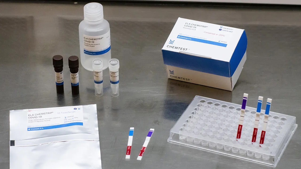 Científicos argentinos desarrollaron un test que detecta COVID-19 hasta cuatro veces más rápido Científicos argentinos desarrollaron un test que detecta COVID-19 hasta cuatro veces más rápido