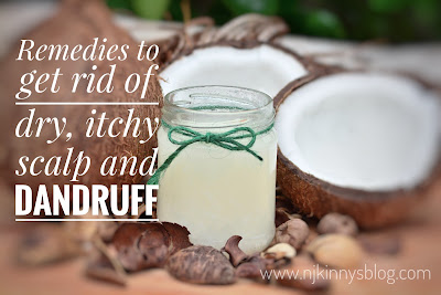 Remedies to get rid of dry, itchy scalp and dandruff- NWoBS Blog Remedies to get rid of dry, itchy scalp and dandruff- NWoBS Blog