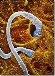 Foto Proses Sperma Berkembang Menjadi Janin, Ini Sangat Fakta Foto Proses Sperma Berkembang Menjadi Janin, Ini Sangat Fakta