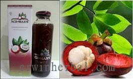 Penyebab, Gejala serta Pengobatan Kista Ovarium Penyebab, Gejala serta Pengobatan Kista Ovarium