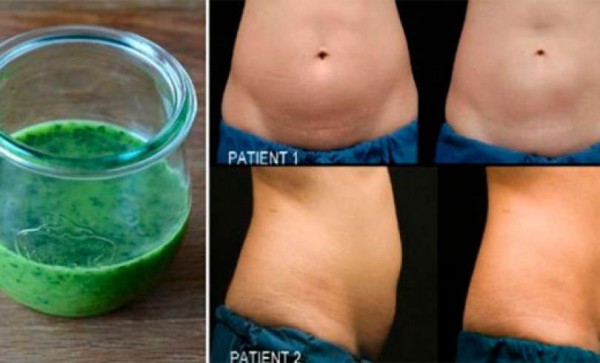 perder dos kilos por semana