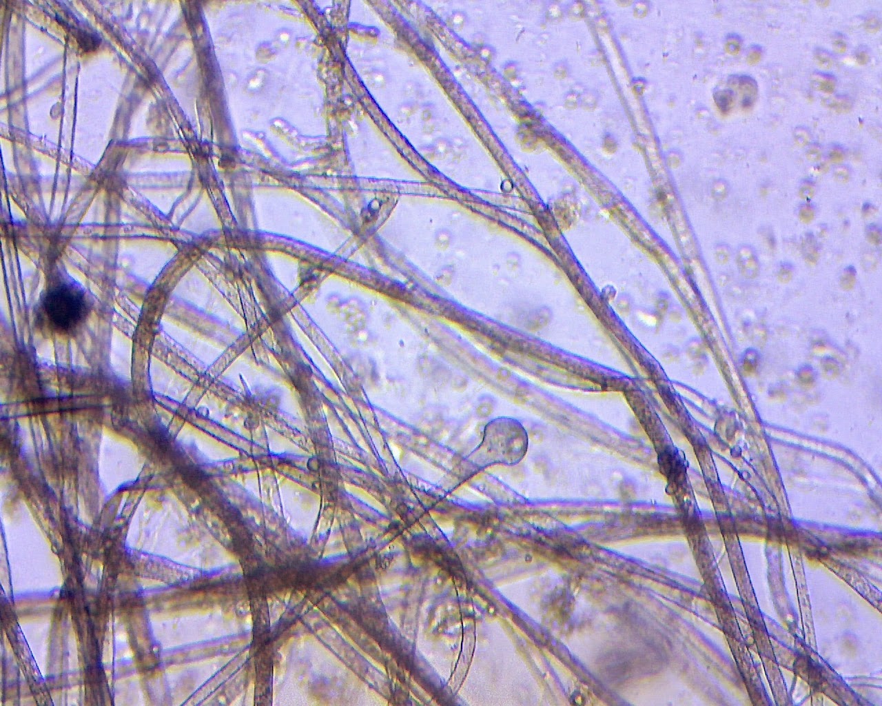 Нити мицелия споры. Микроспорум плесневый гриб. Мицелий мукора под микроскопом. Мицелий аспергилла. Плесневый грибок рода Microsporum.