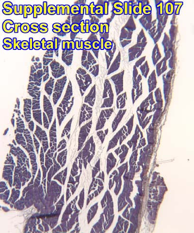 HISTOLOGY PICTURES: Muscle