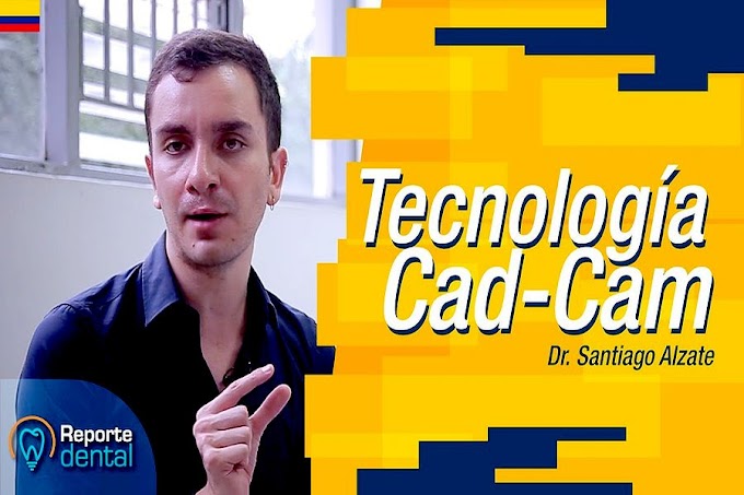 Tecnología Cad-Cam - Dr. Santiago Alzate