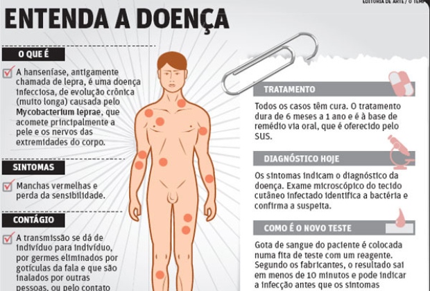 Resultado de imagem para hanseniase
