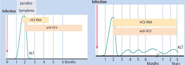 Ilustrasi perbedaan serologis HCV akut (kiri) dan HCV kronis (kanan), hepatitis C virus akut diagram kurva jumlah infeksi terhadap waktu bulan HCV RNA, Jaundice, gejala, symptoms, 