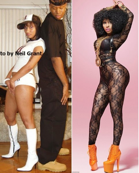 nicki minaj buttocks implants before and after