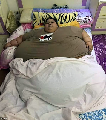 World's fattest woman Iman Ahmad Abdulati