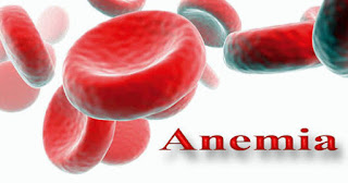 penyebab penyakit Anemia http://www.udan.name penyebab penyakit Anemia http://www.udan.name
